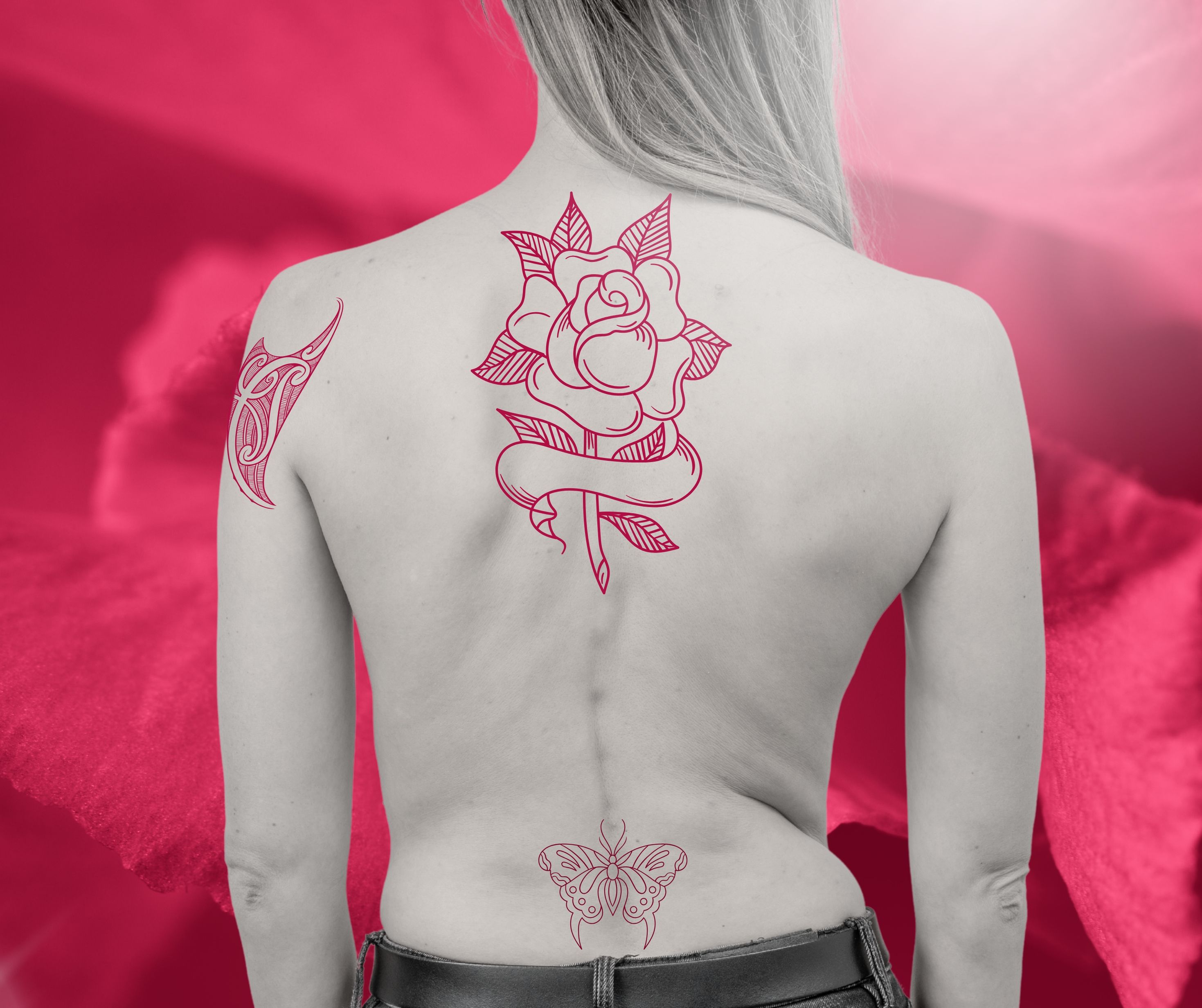 Tatoo Removal