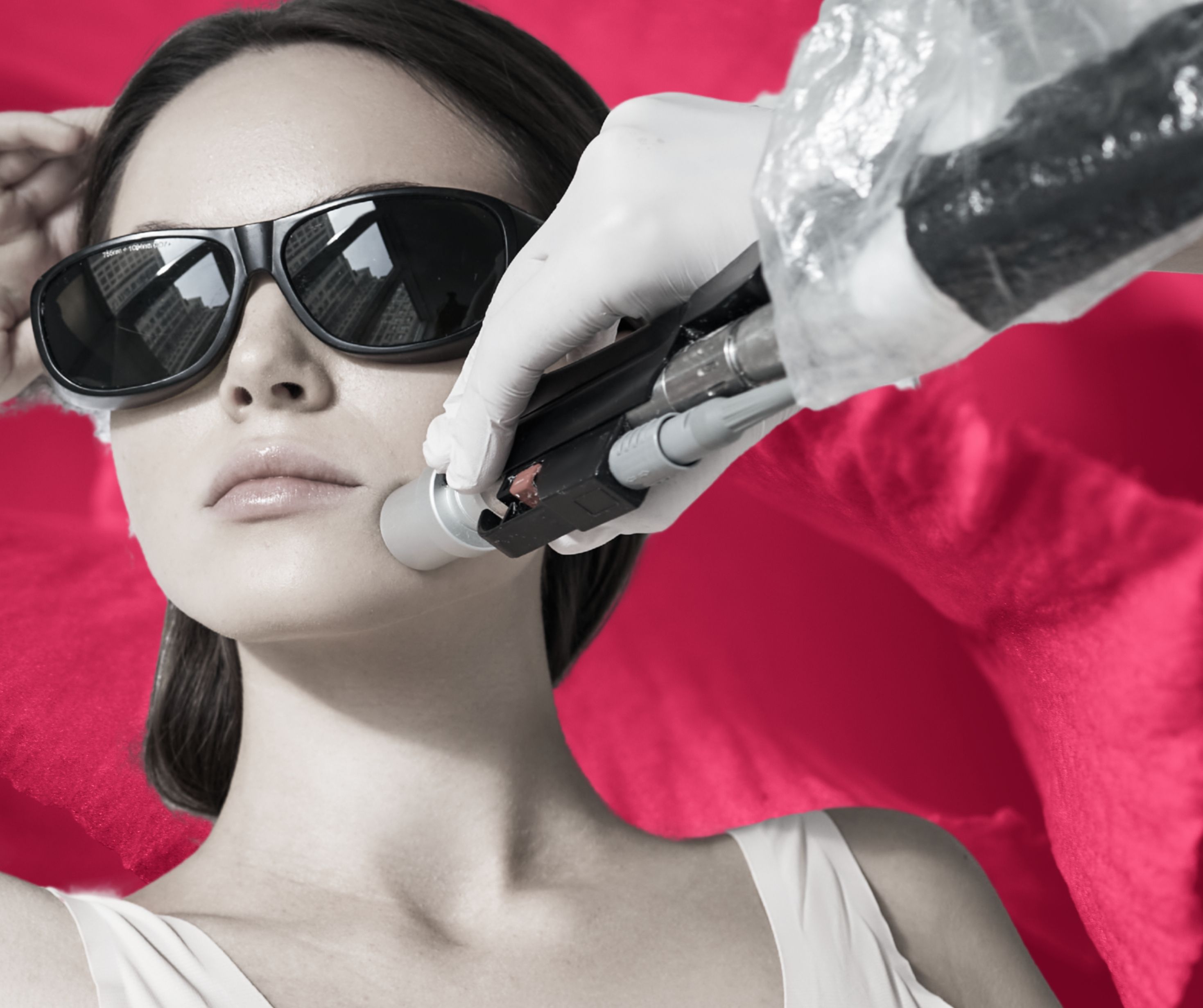 Laser Hair Removal